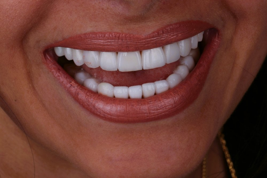 Slider image (6) Bright Way Dental Clinic